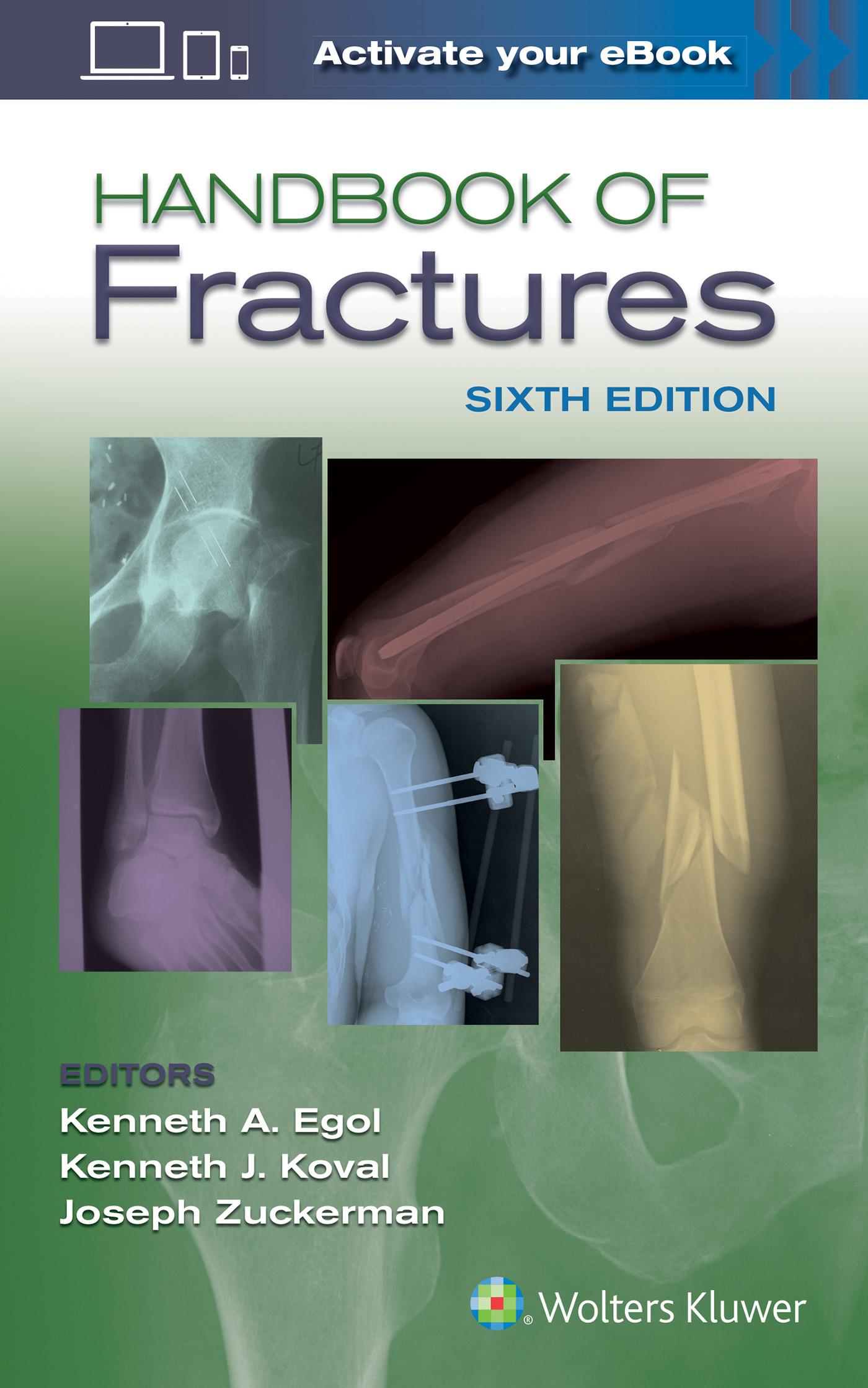 Vorderes Coverbild Handbook of Fractures