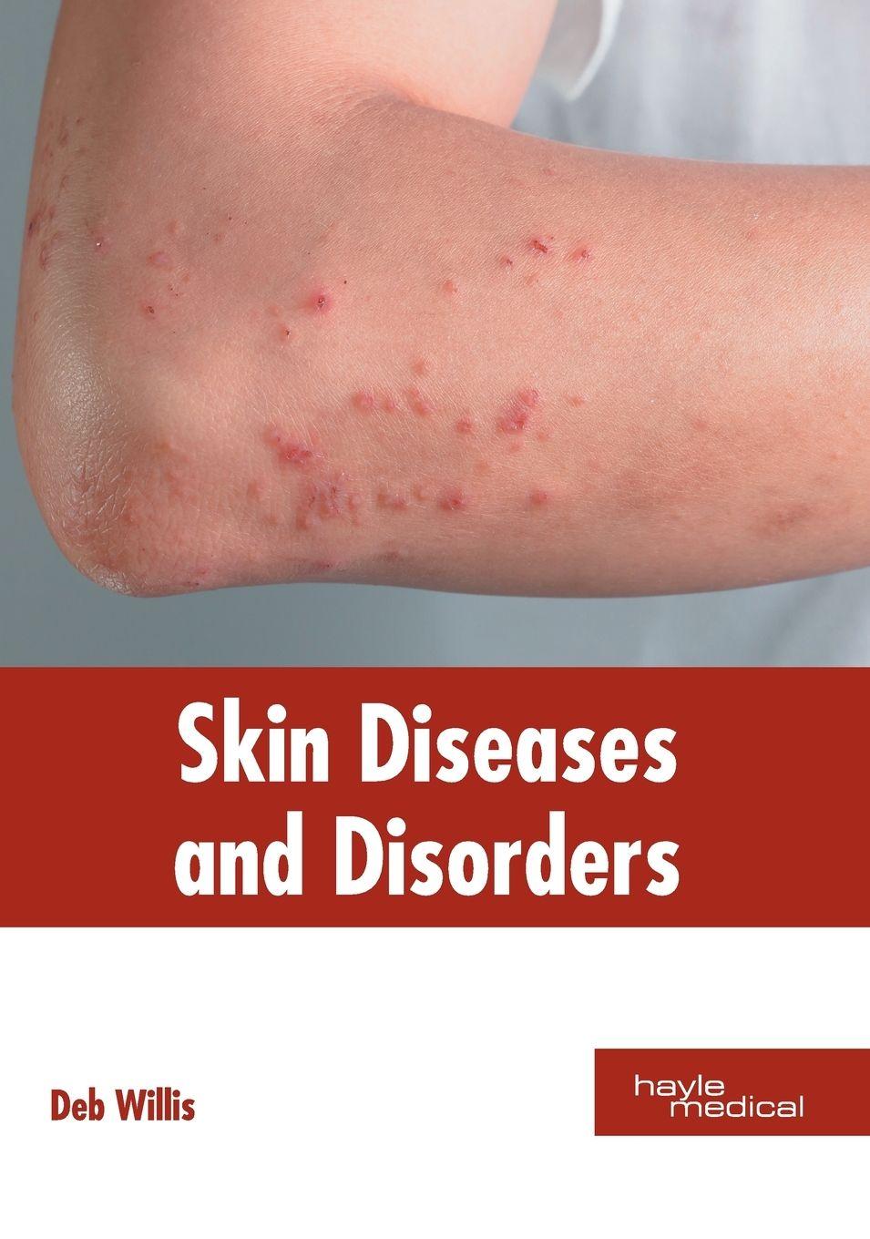 Vorderes Coverbild Skin Diseases and Disorders