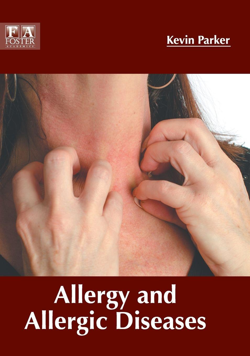 Vorderes Coverbild Allergy and Allergic Diseases