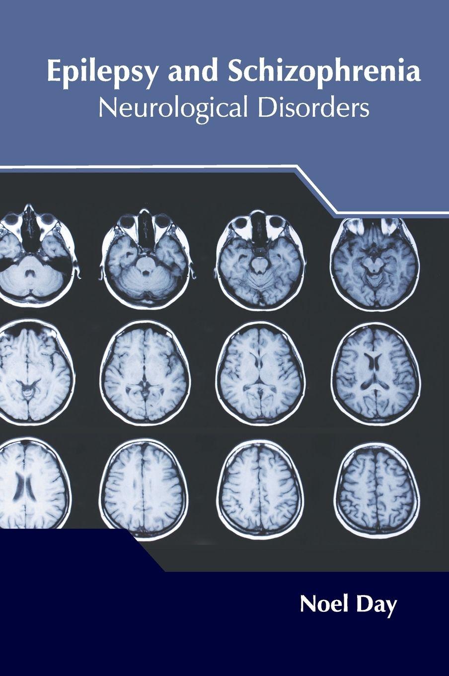 Vorderes Coverbild Epilepsy and Schizophrenia