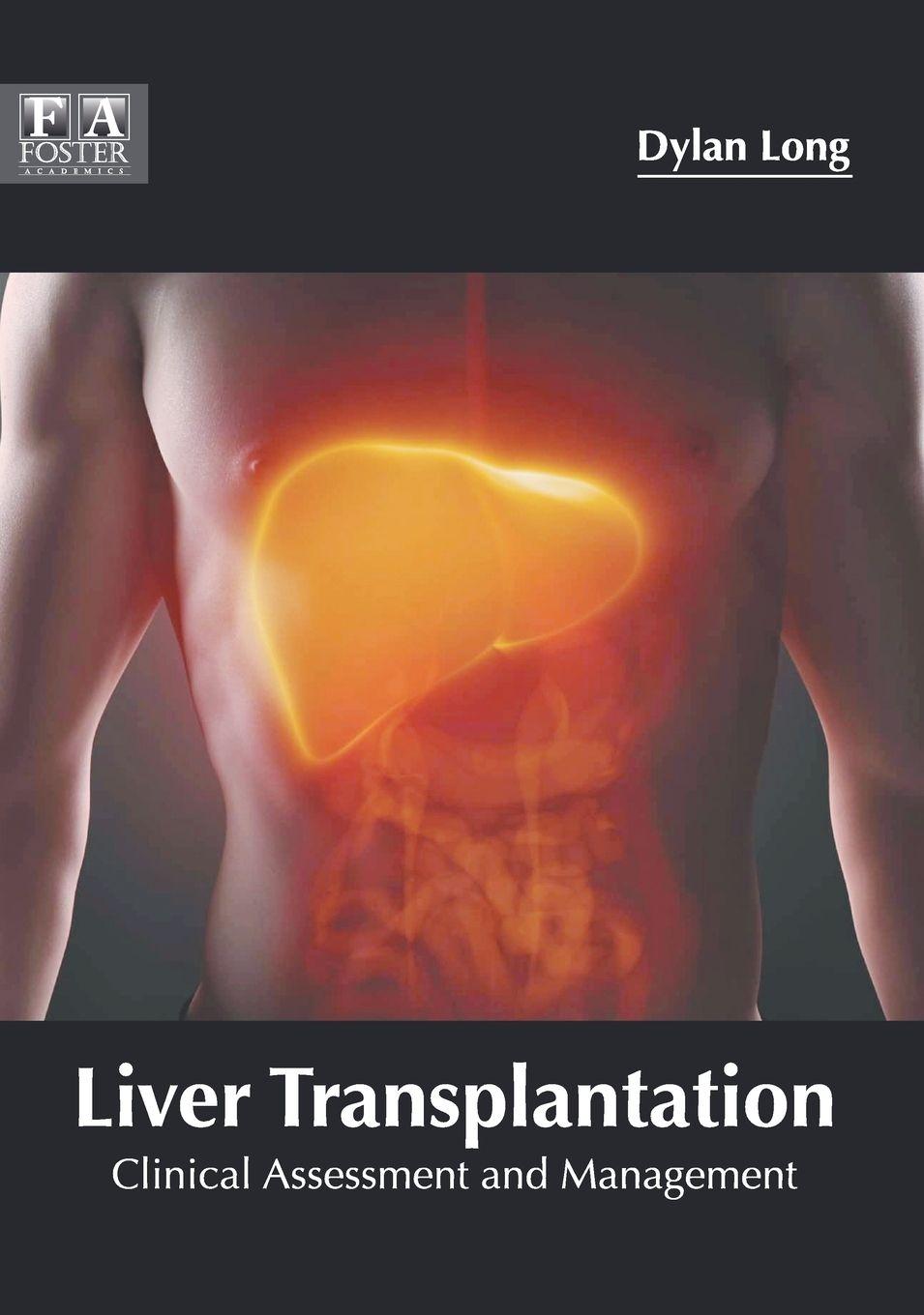 Vorderes Coverbild Liver Transplantation