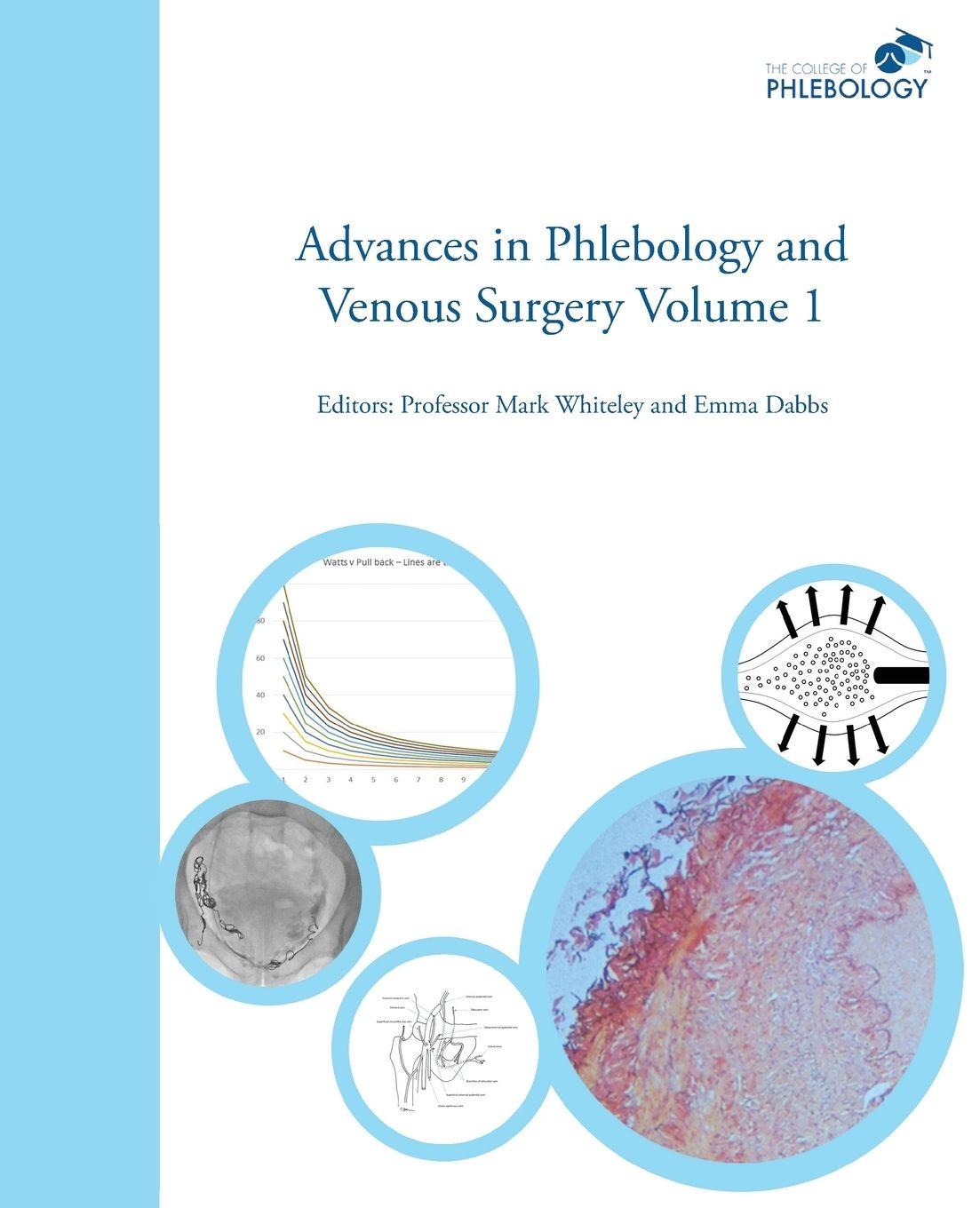 Vorderes Coverbild Advances in Phlebology and Venous Surgery Volume 1