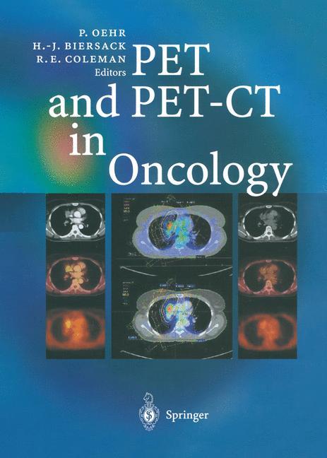 Vorderes Coverbild PET and PET-CT in Oncology