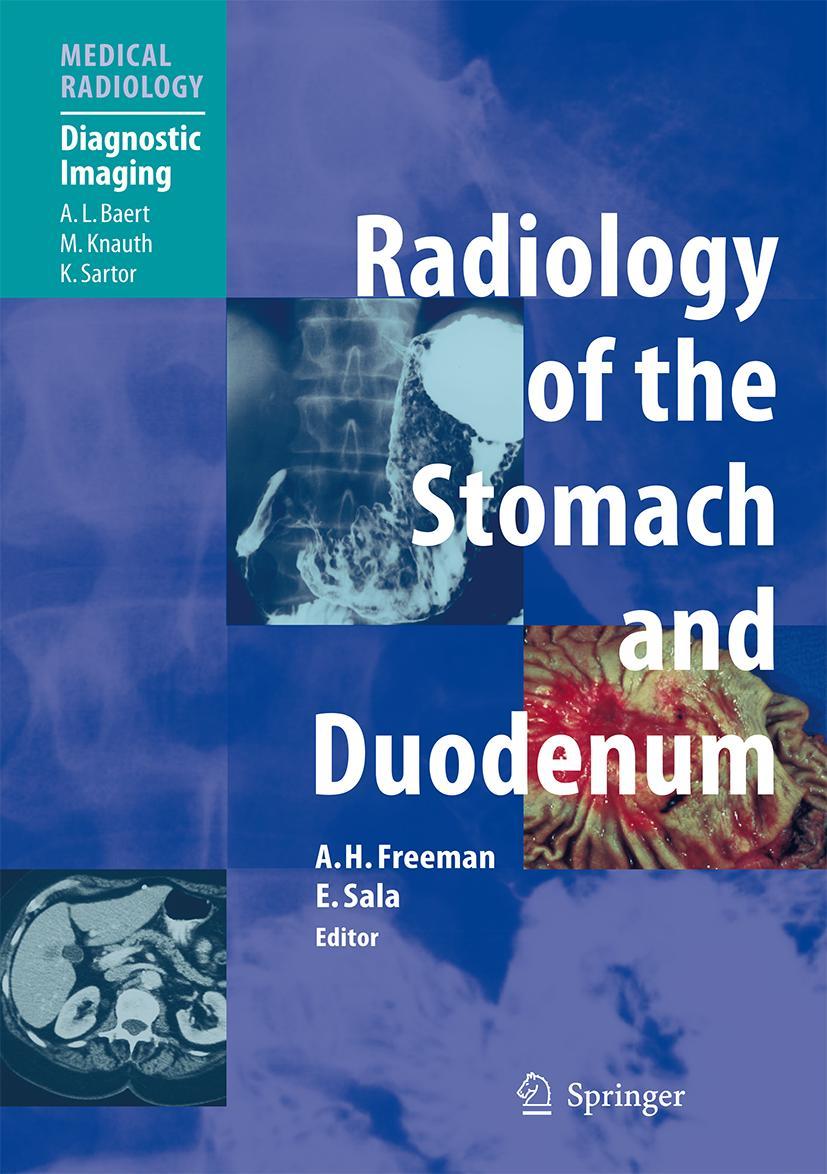 Vorderes Coverbild Radiology of the Stomach and Duodenum