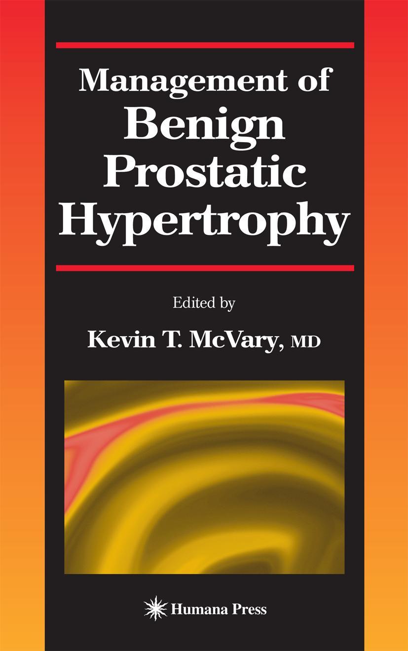Vorderes Coverbild Management of Benign Prostatic Hypertrophy