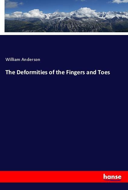 Vorderes Coverbild The Deformities of the Fingers and Toes