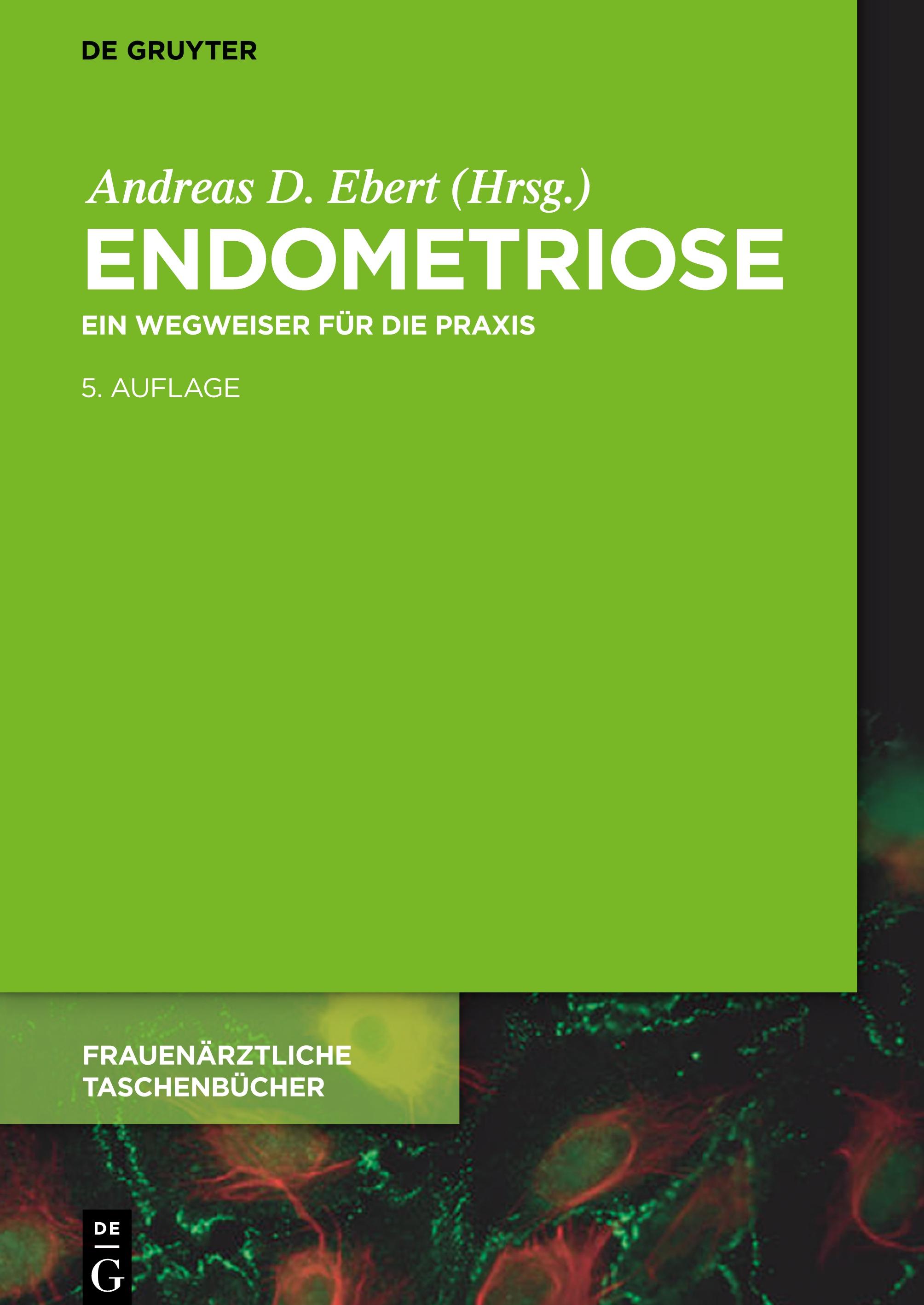 Vorderes Coverbild Endometriose