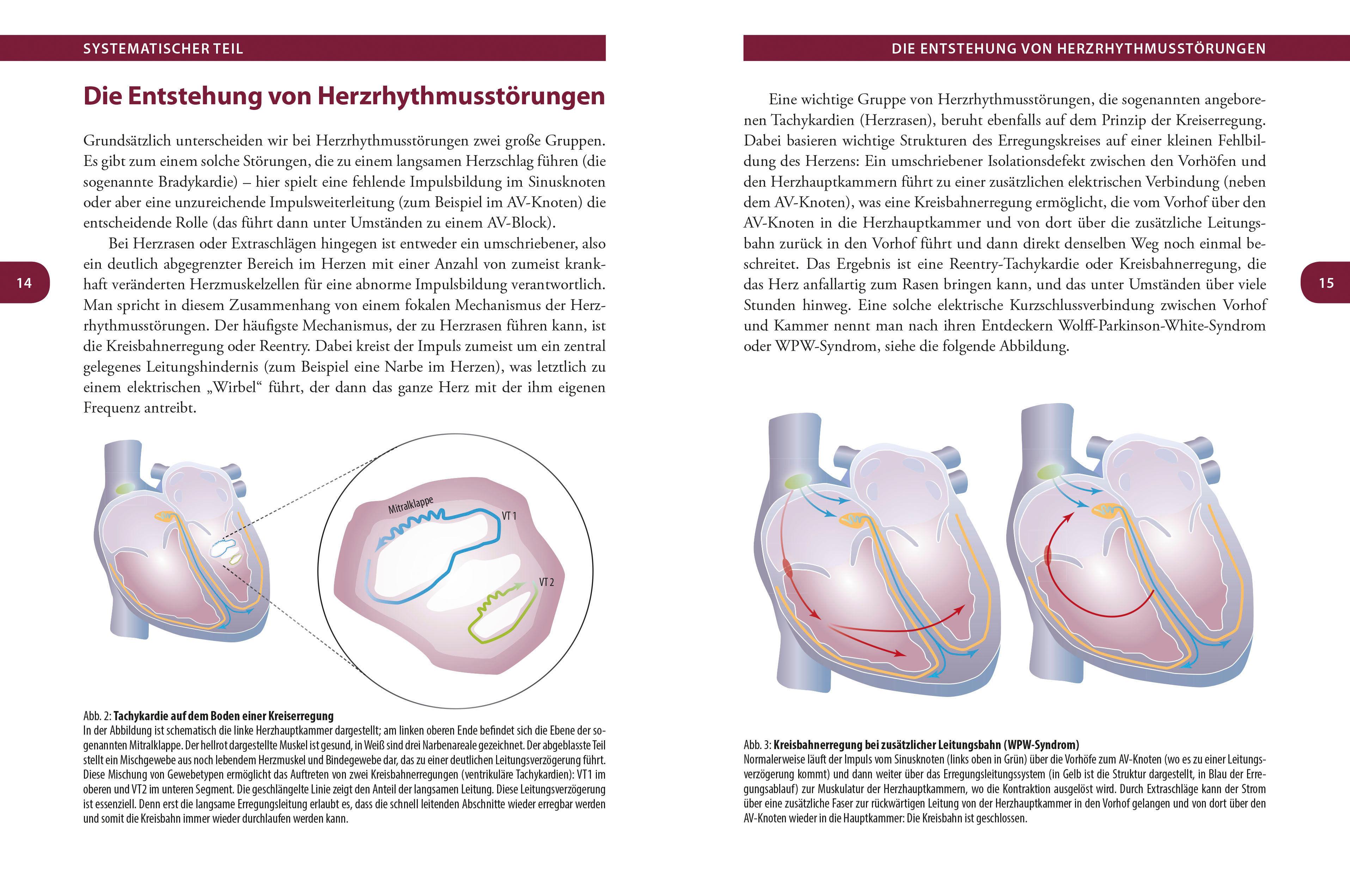 Beispielinhalt (Bild) Herzrhythmus - Der Takt des Lebens. Herzrhythmusstörungen verstehen und behandeln