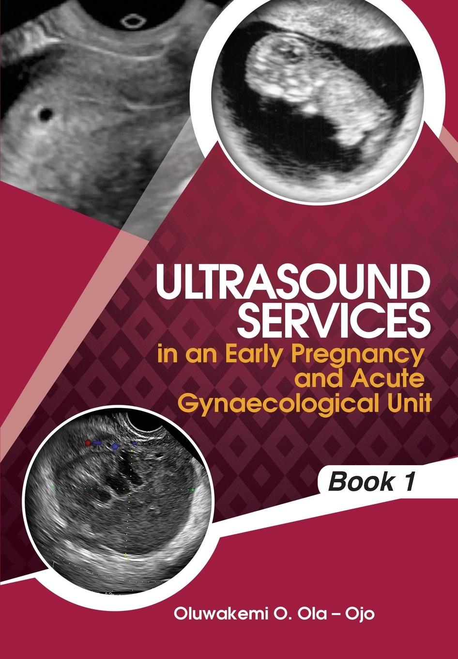 Vorderes Coverbild Ultrasound Services in An Early Pregnancy and Acute Gynaecological Unit