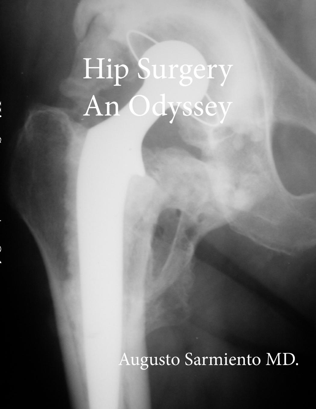 Vorderes Coverbild Hip Surgery - An Odyssey