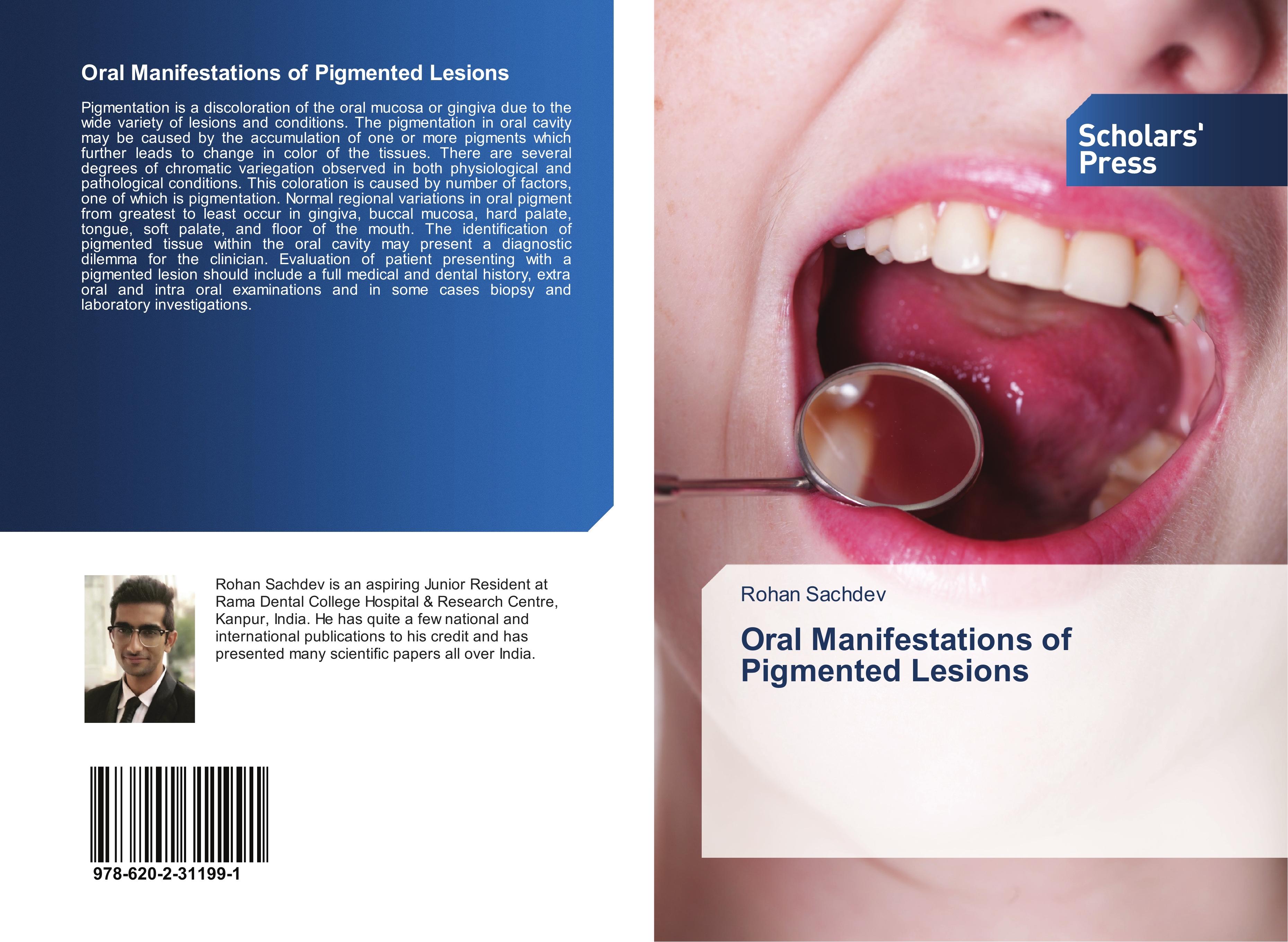 Vorderes Coverbild Oral Manifestations of Pigmented Lesions