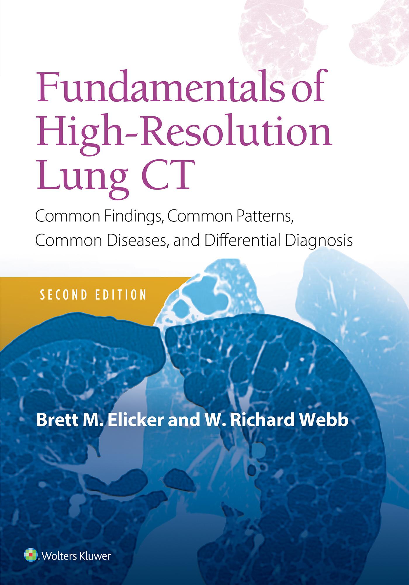 Vorderes Coverbild Fundamentals of High-Resolution Lung CT