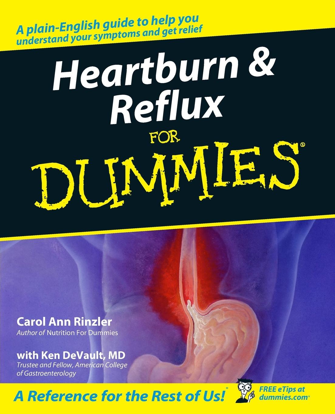 Vorderes Coverbild Heartburn and Reflux For Dummies