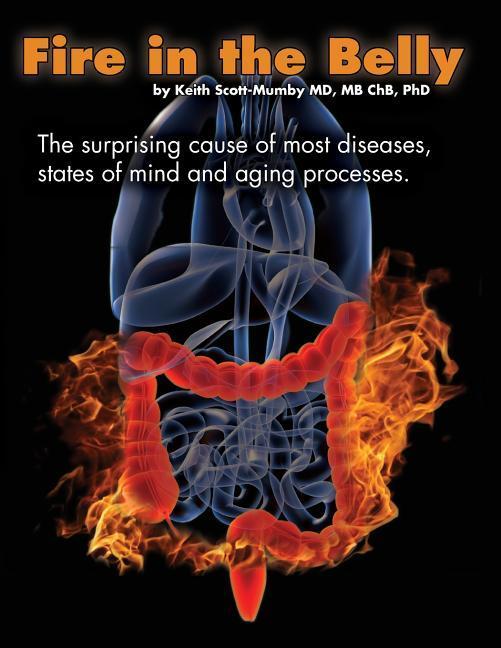 Vorderes Coverbild Fire In The Belly: The Surprising Cause of Most Diseases, States Of Mind and Aging Processes