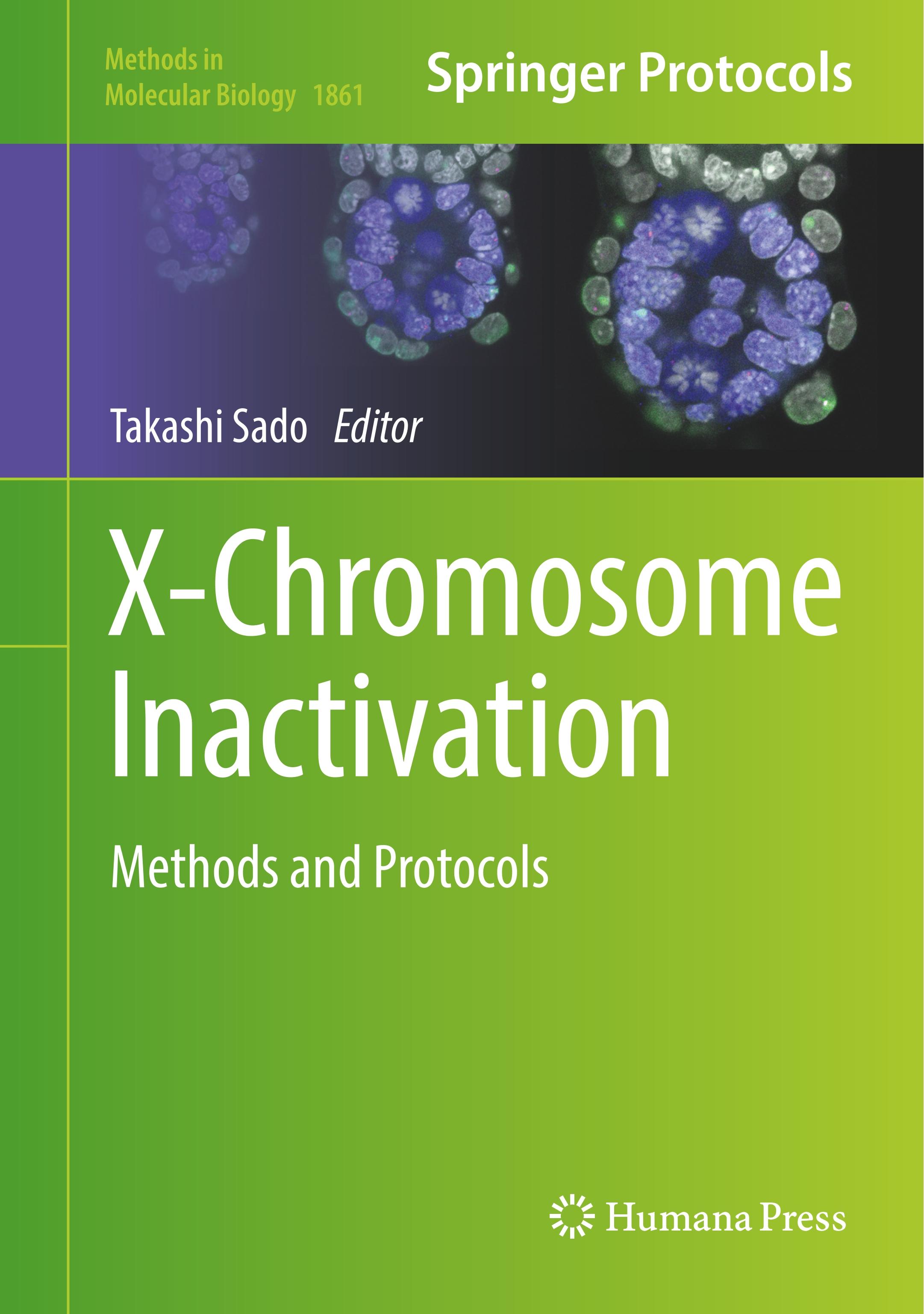 Vorderes Coverbild X-Chromosome Inactivation