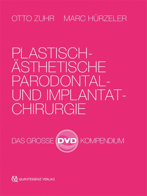 Vorderes Coverbild Plastisch-Ästhetische Parodontal- und Implantatchirurgie