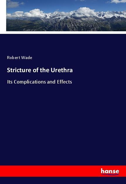 Vorderes Coverbild Stricture of the Urethra