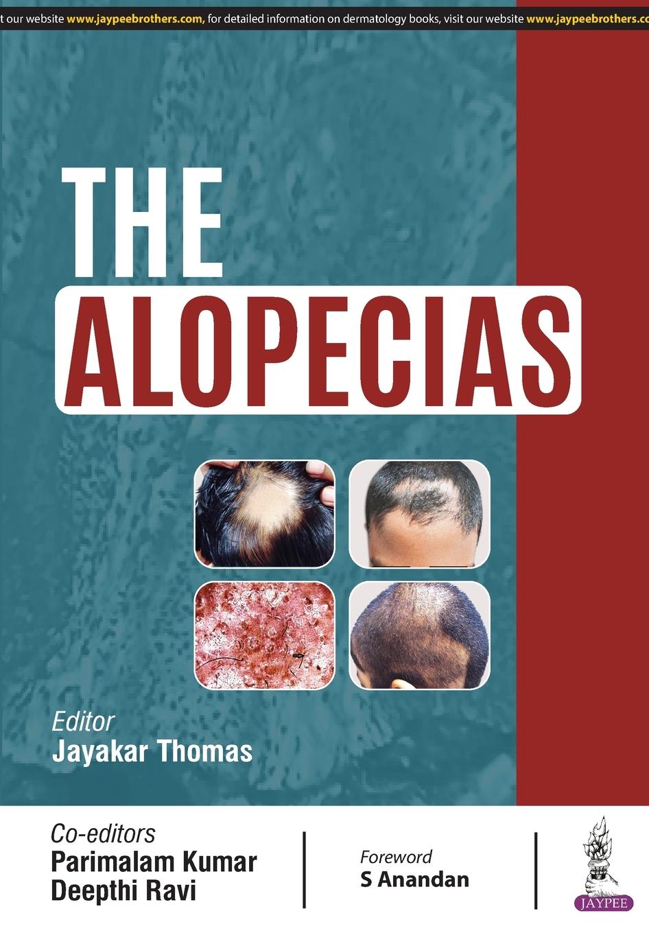 Vorderes Coverbild THE ALOPECIAS