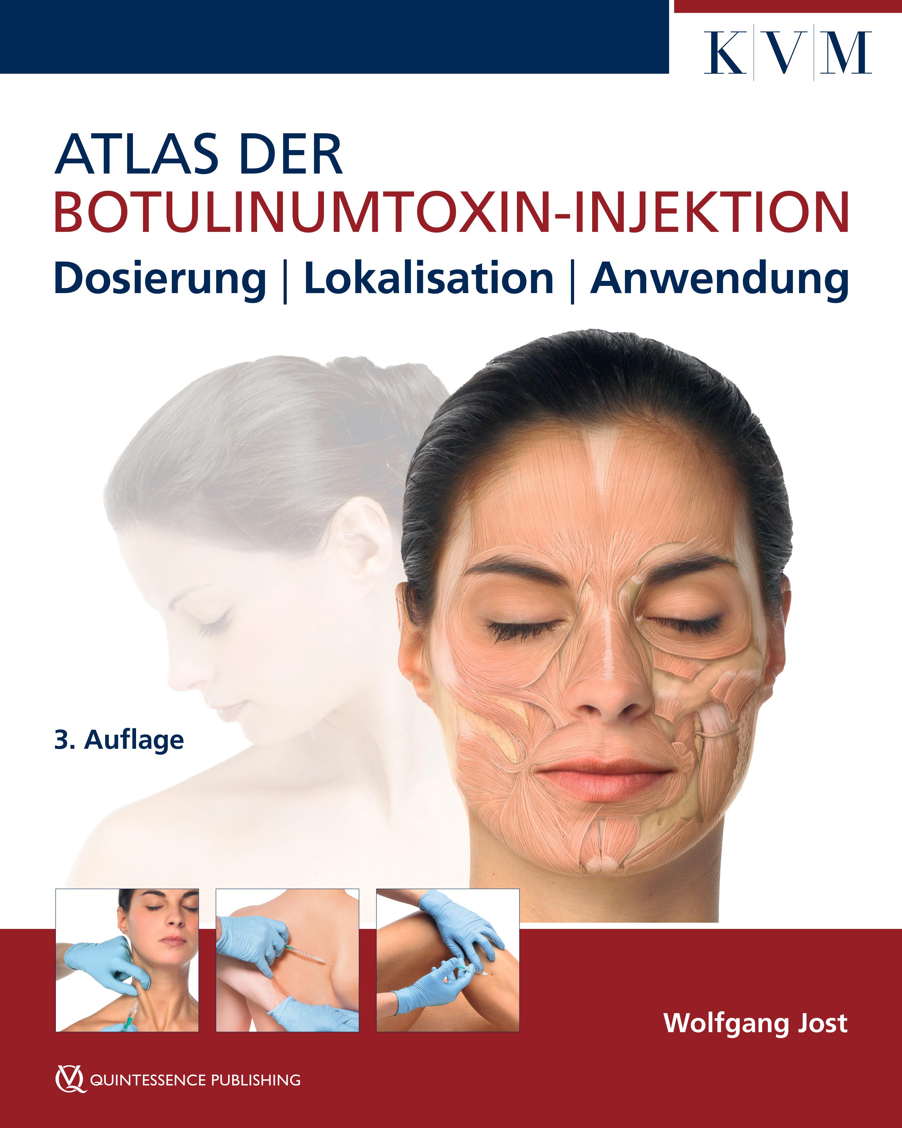 Vorderes Coverbild Atlas der Botulinumtoxin-Injektion
