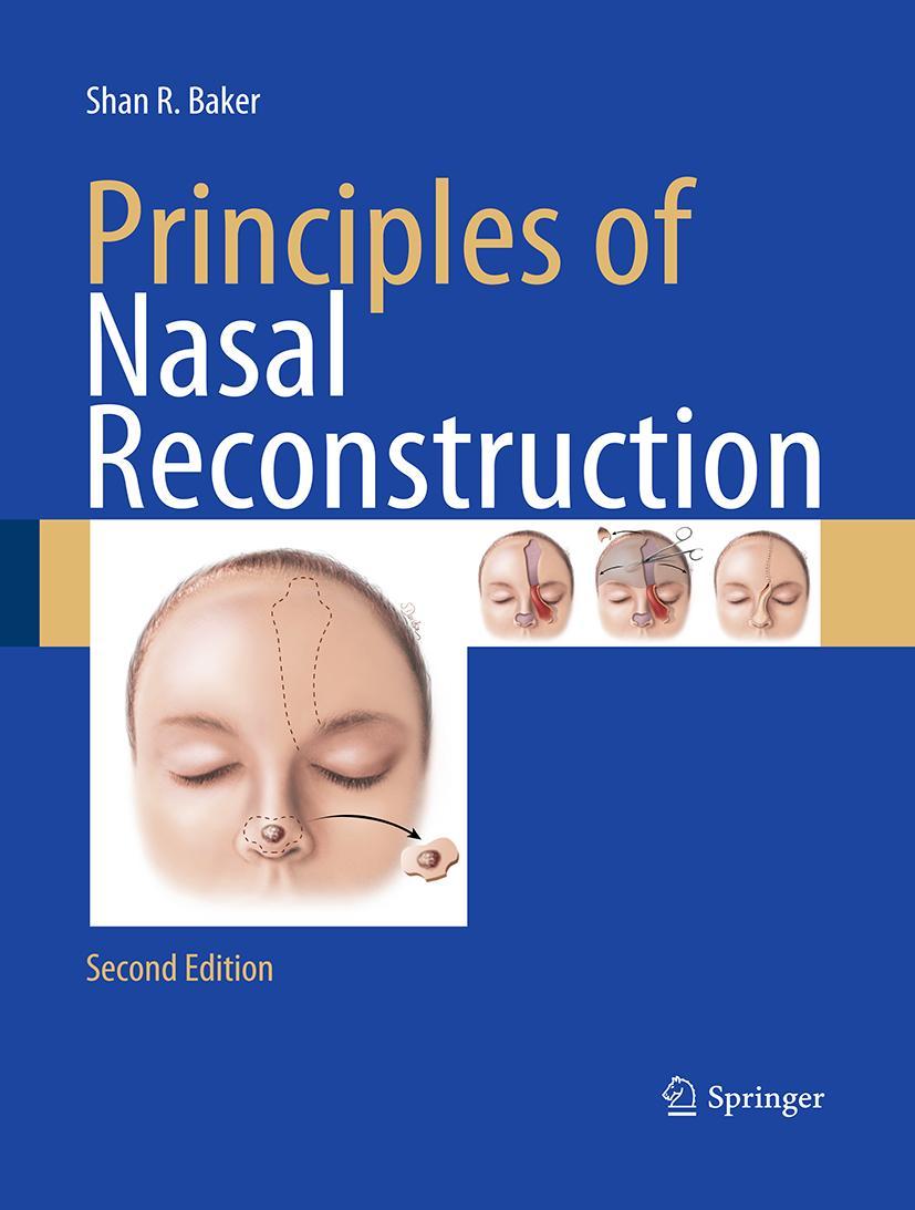 Vorderes Coverbild Principles of Nasal Reconstruction