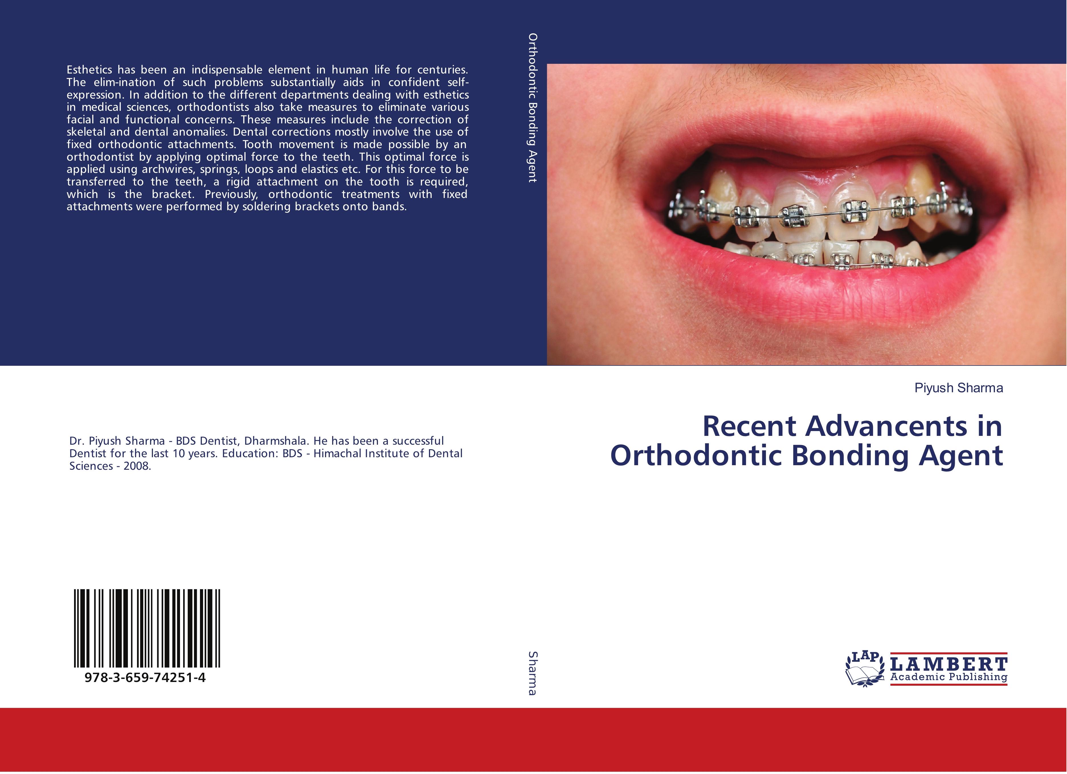 Vorderes Coverbild Recent Advancents in Orthodontic Bonding Agent