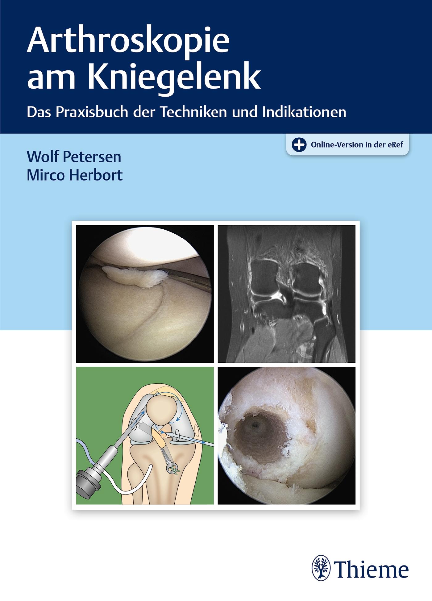 Vorderes Coverbild Arthroskopie am Kniegelenk