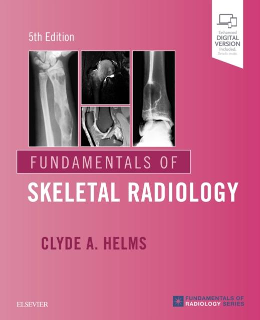 Vorderes Coverbild Fundamentals of Skeletal Radiology