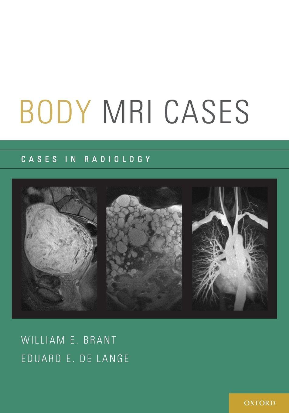 Vorderes Coverbild Body MRI Cases