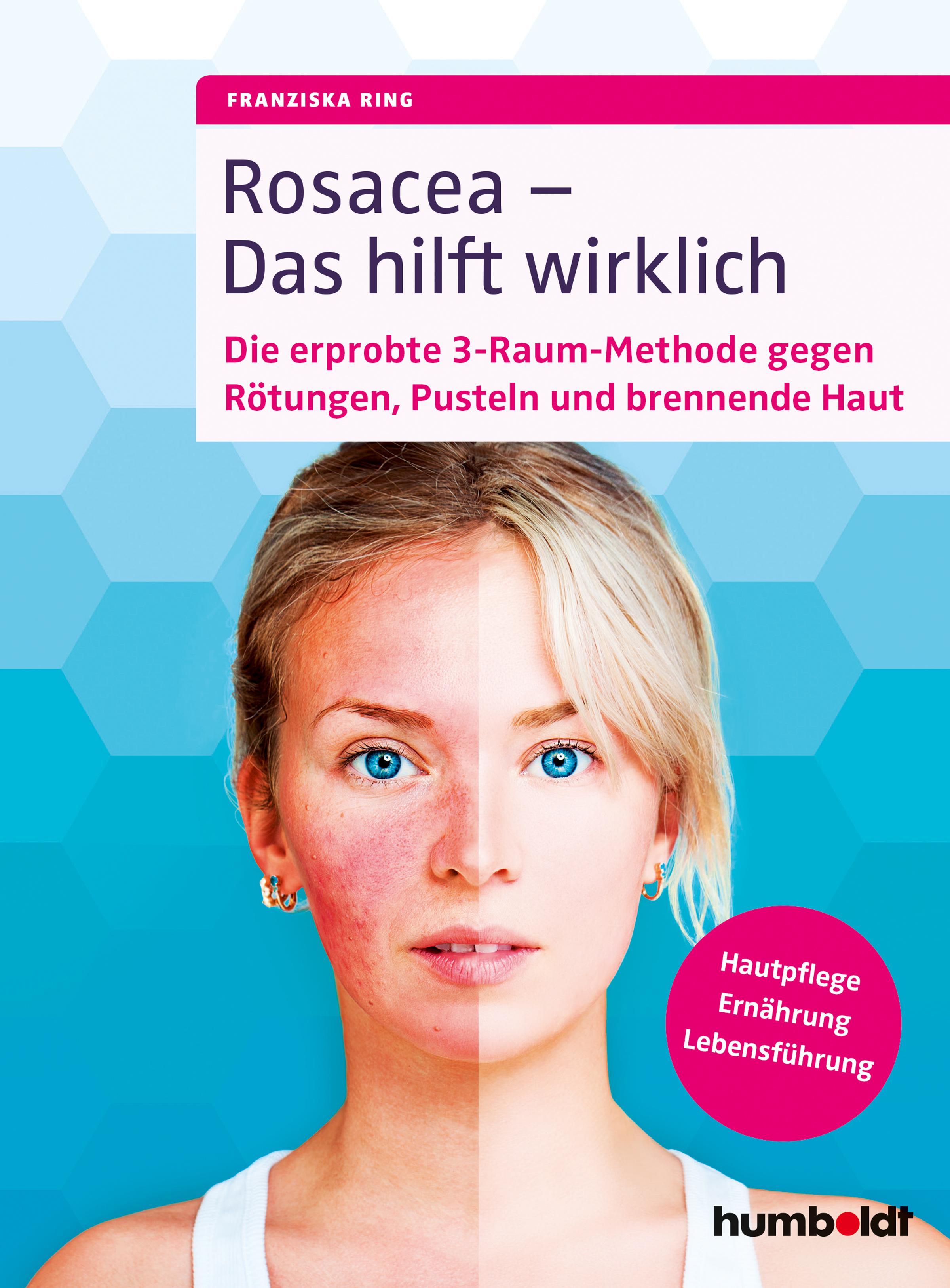 Vorderes Coverbild Rosacea - Das hilft wirklich