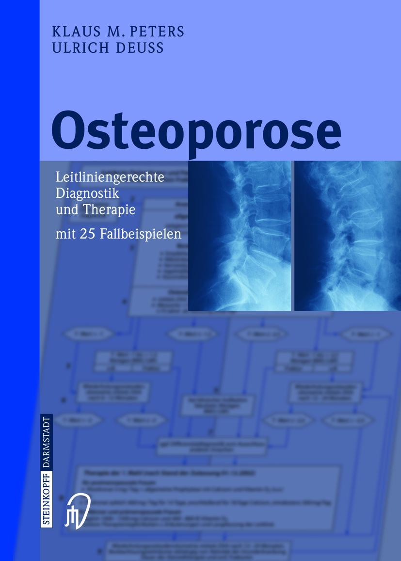 Vorderes Coverbild Osteoporose
