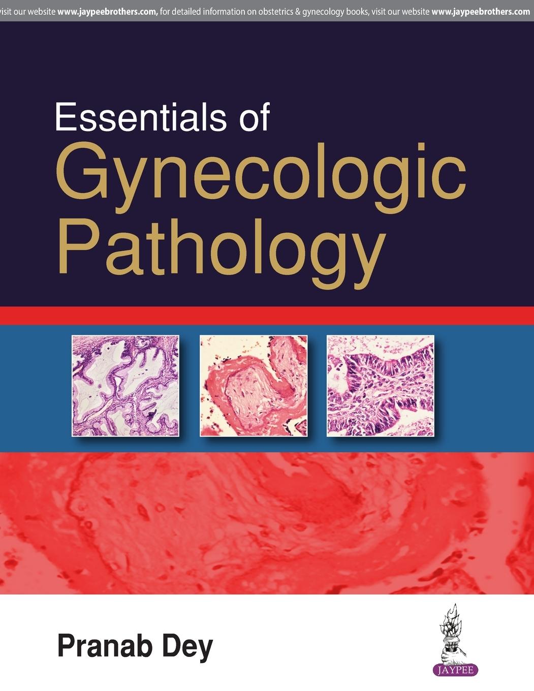 Vorderes Coverbild ESSENTIALS OF GYNECOLOGIC PATHOLOGY