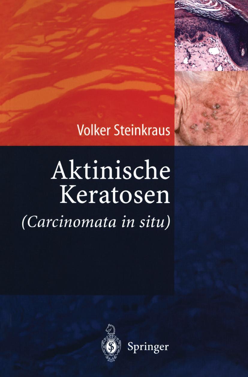Vorderes Coverbild Aktinische Keratosen (Carcinomata in situ)