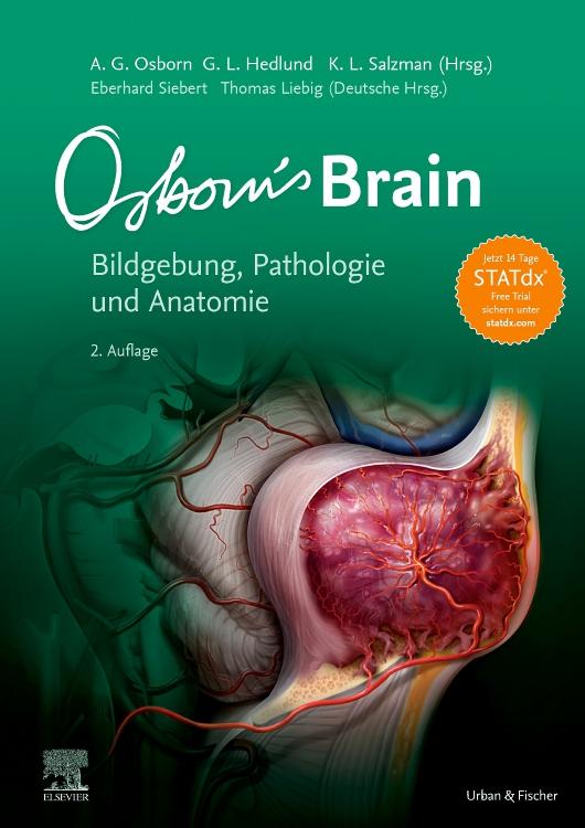 Vorderes Coverbild Osborn's Brain