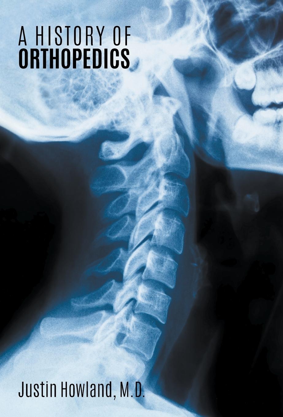 Vorderes Coverbild A History Of Orthopedics