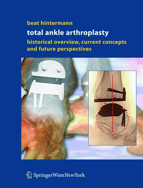 Vorderes Coverbild Total Ankle Arthroplasty