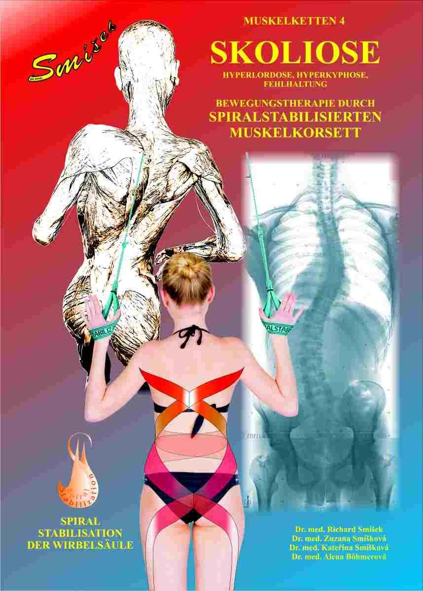 Vorderes Coverbild Skoliose