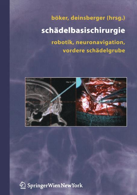 Vorderes Coverbild Schädelbasischirurgie