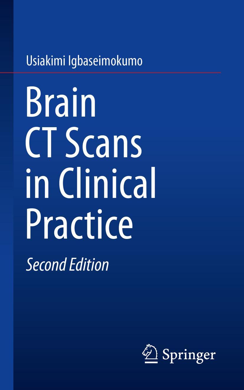 Vorderes Coverbild Brain CT Scans in Clinical Practice