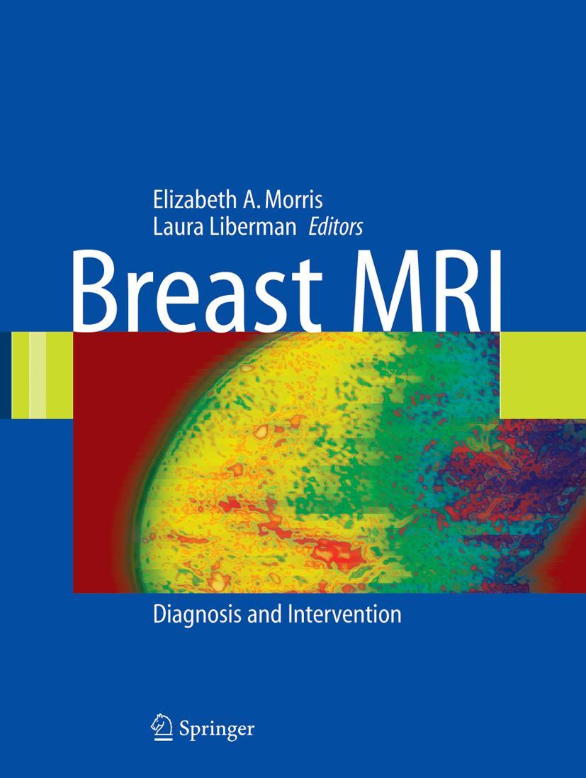 Vorderes Coverbild Breast MRI