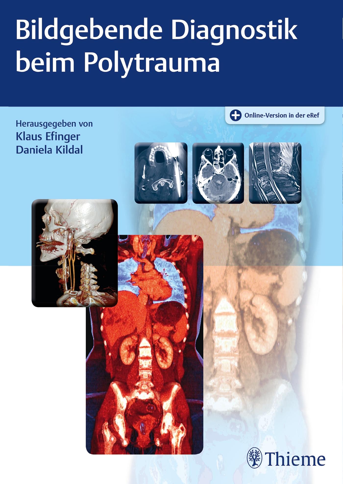Vorderes Coverbild Bildgebende Diagnostik beim Polytrauma