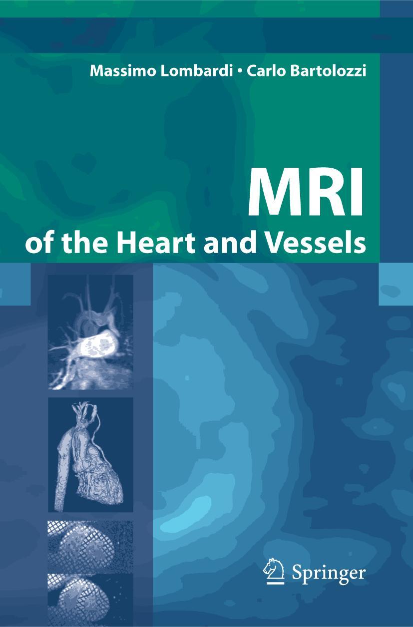 Vorderes Coverbild MRI of the Heart and Vessels