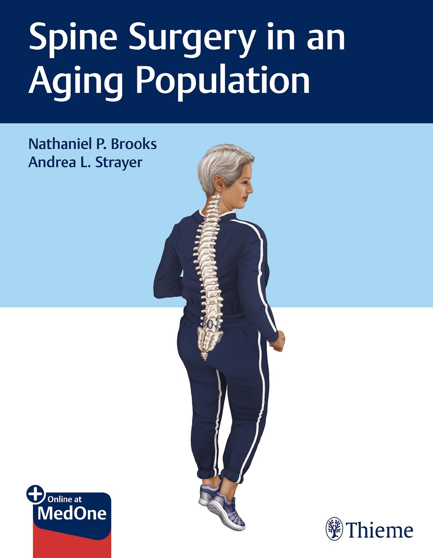 Vorderes Coverbild Spine Surgery in an Aging Population