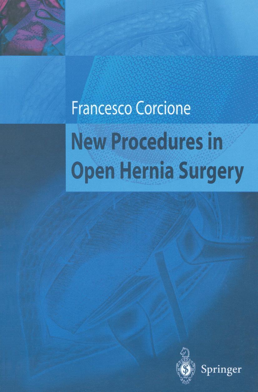 Vorderes Coverbild New Procedures in Open Hernia Surgery
