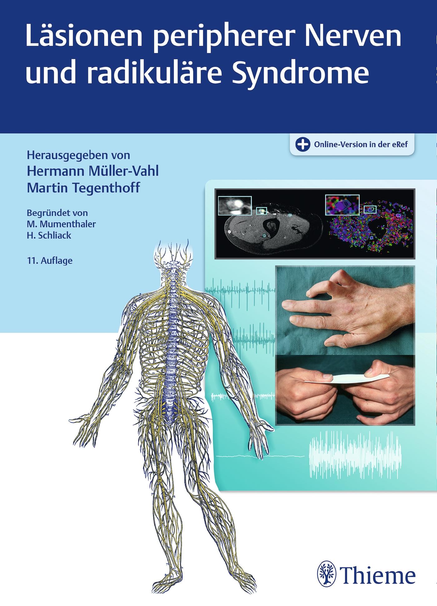 Vorderes Coverbild Läsionen peripherer Nerven und radikuläre Syndrome