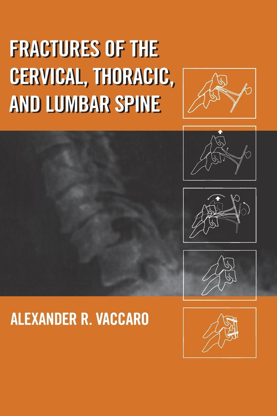 Vorderes Coverbild Fractures of the Cervical, Thoracic, and Lumbar Spine