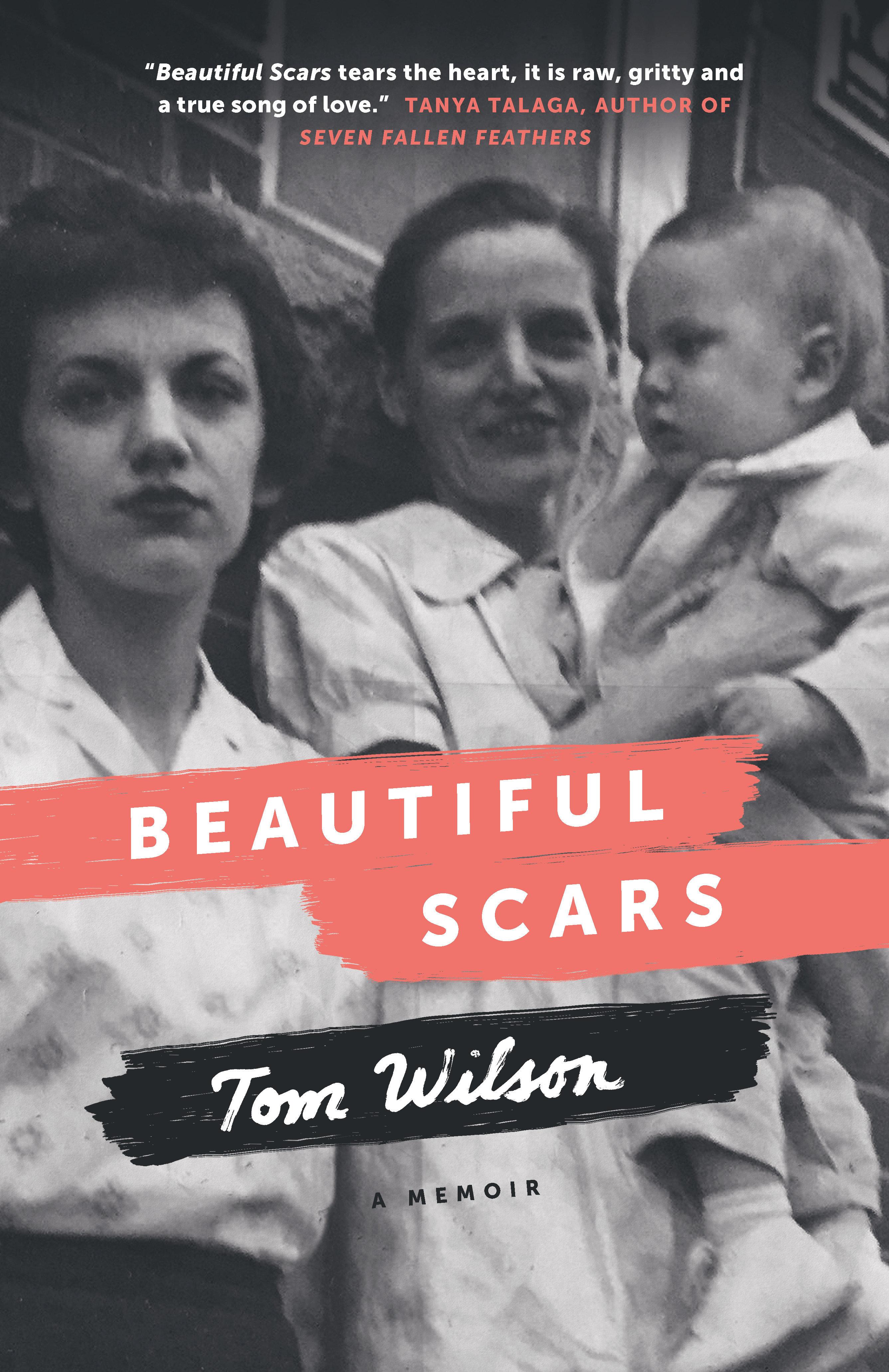 Vorderes Coverbild Beautiful Scars