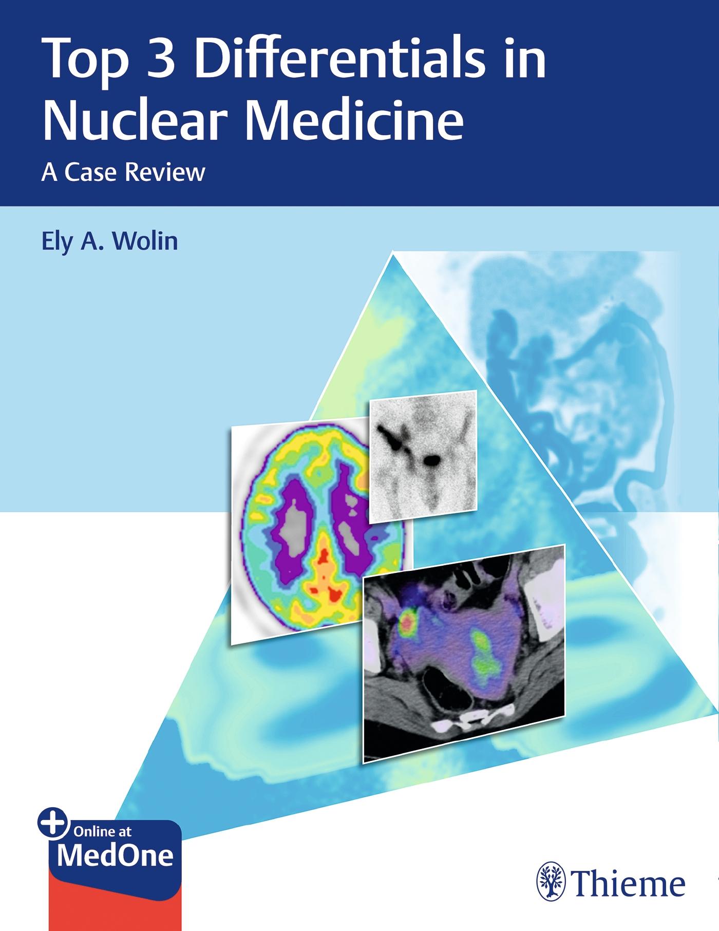 Vorderes Coverbild Top 3 Differentials in Nuclear Medicine