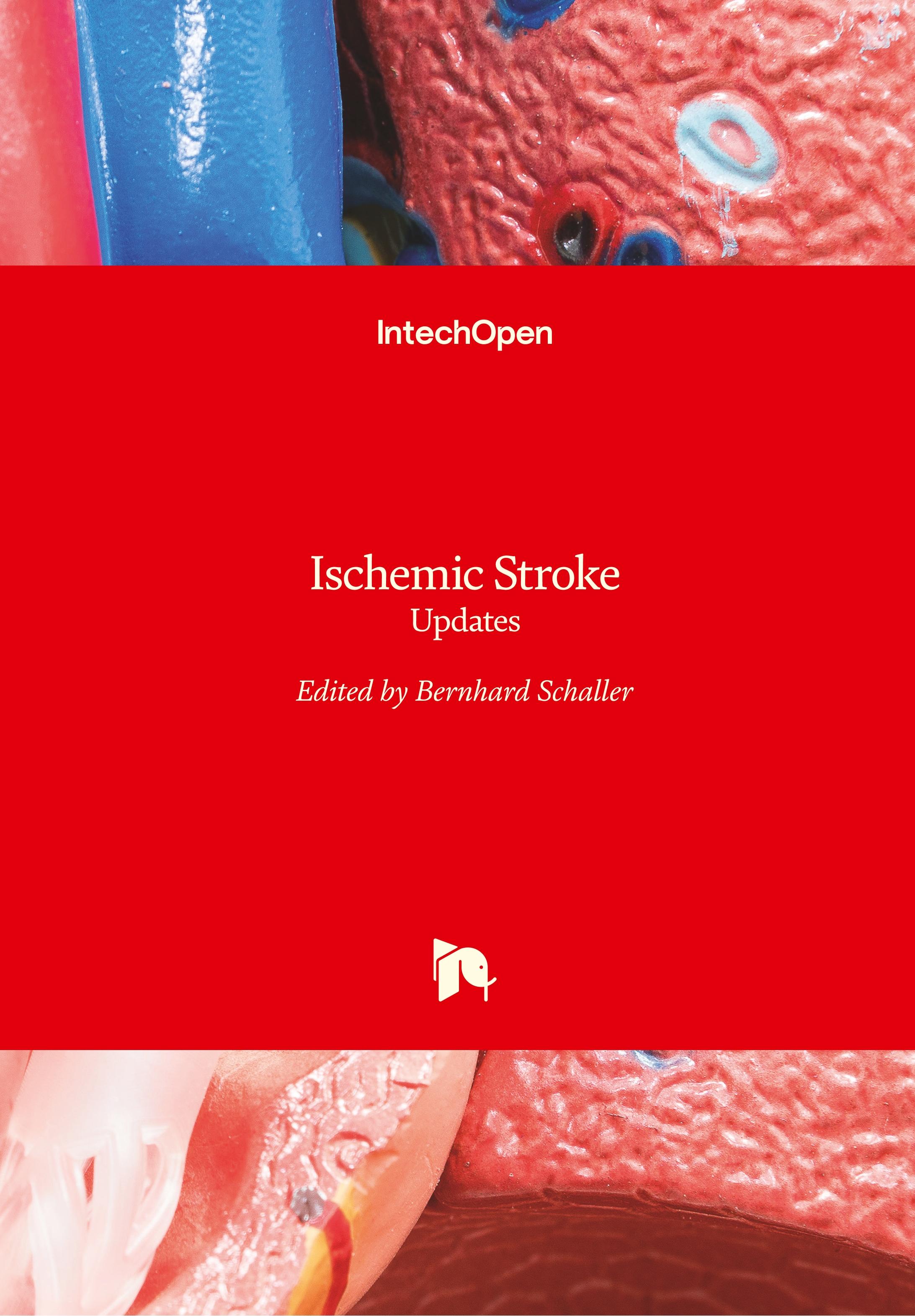 Vorderes Coverbild Ischemic Stroke