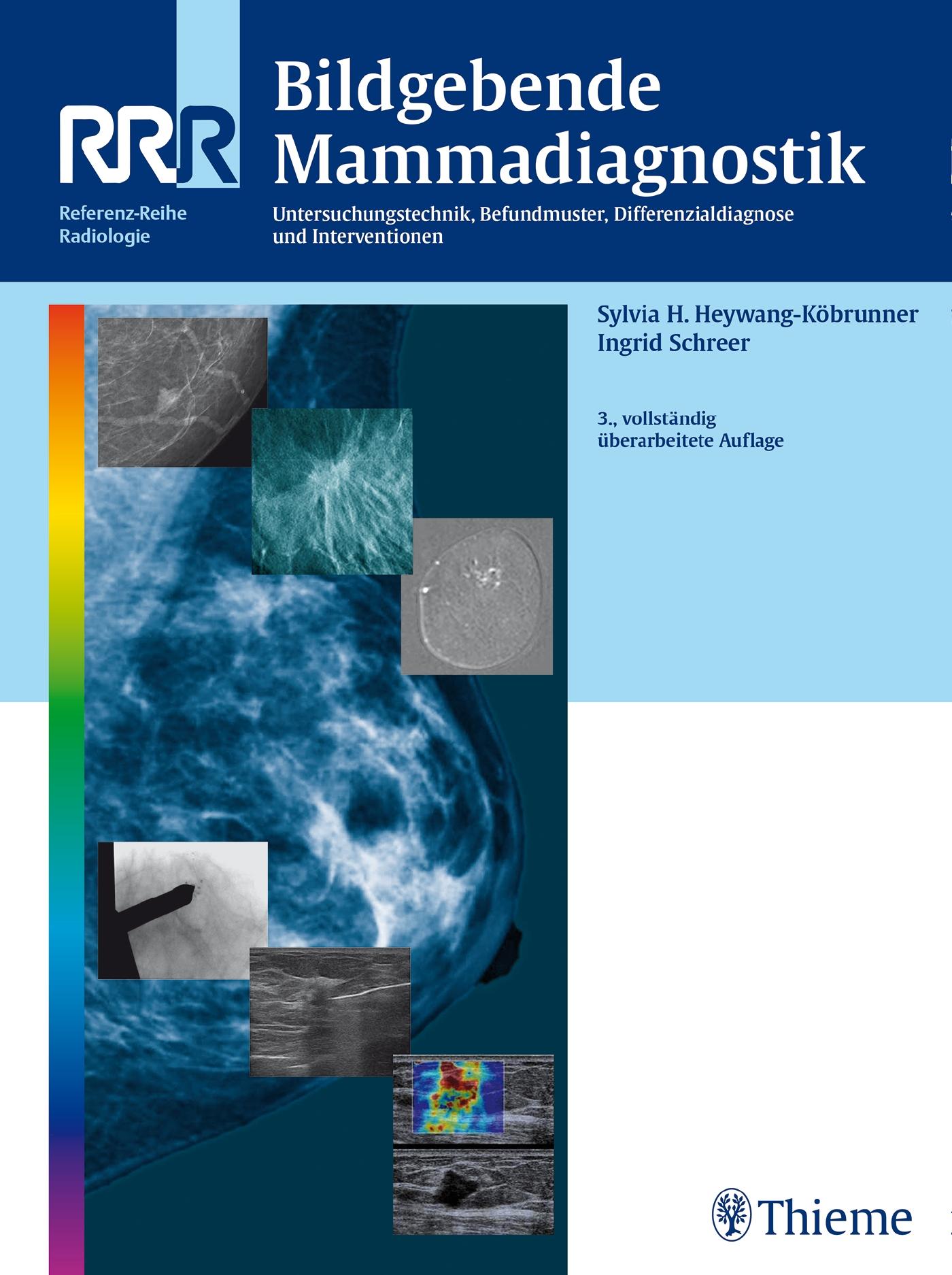 Vorderes Coverbild Bildgebende Mammadiagnostik