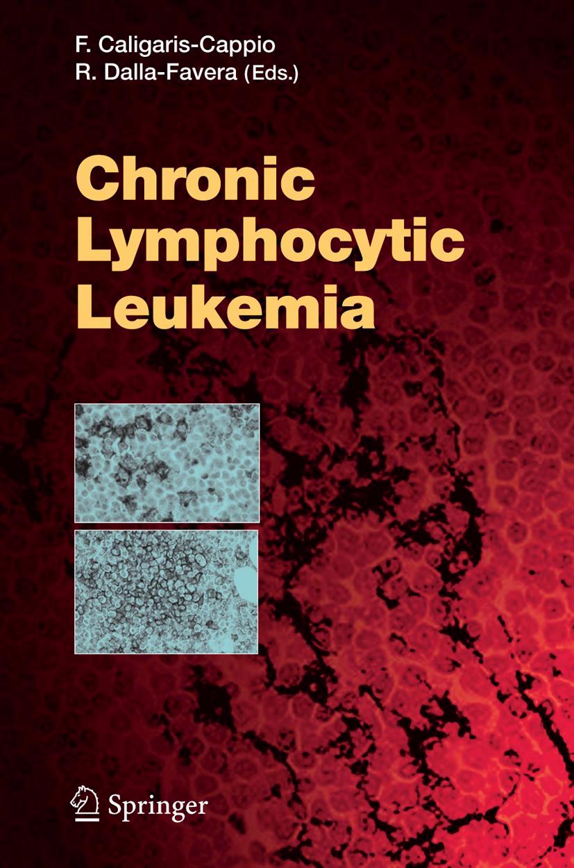 Vorderes Coverbild Chronic Lymphocytic Leukemia